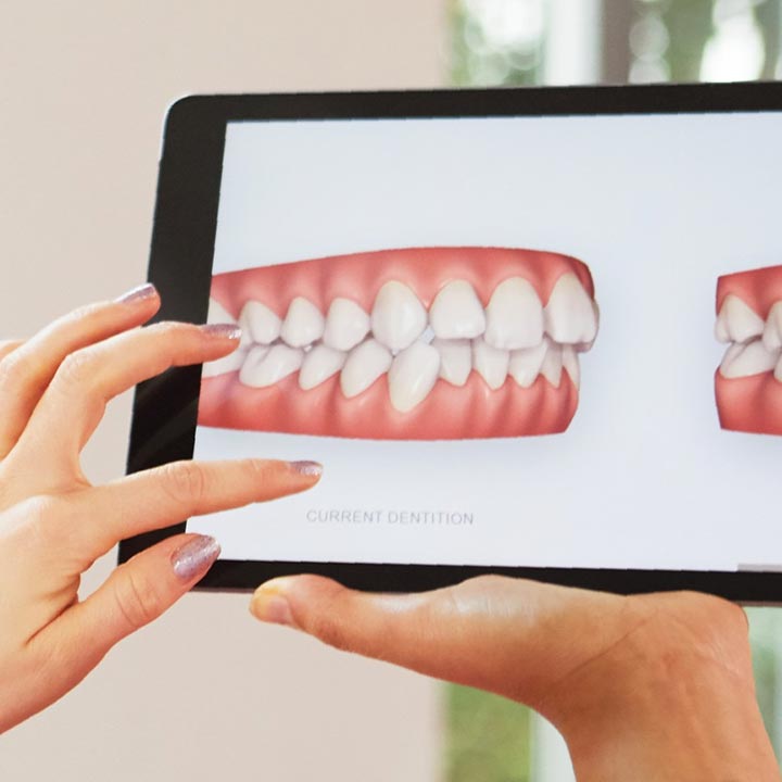 Rilevazione Digitale Impronte